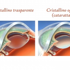 ottica e optometria