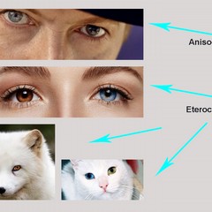 Da cosa dipende il colore degli occhi?