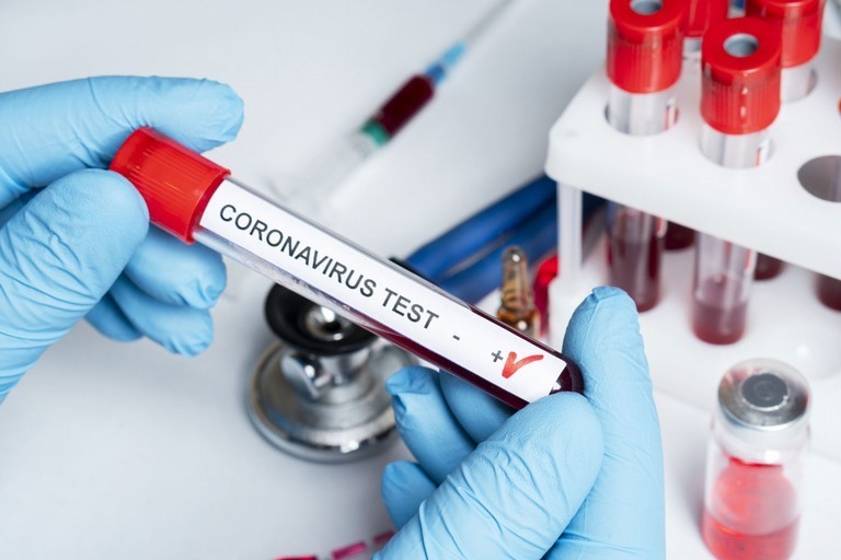 Coronavirus test