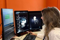 Festa delle Donna: al "Bonomo" di Andria esami di mammografia dalle 8 alle 14 presso la Radiologia