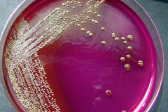 Escherichia Coli nei reflui, Acquedotto Pugliese si difende