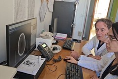 Al Bonomo di Andria un farmaco innovativo per il trattamento dell'ictus utilizzato con successo in Neurologia