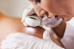 "Salviamoci la pelle": prevenire e curare melanoma ad Andria