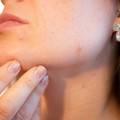 Skincare routine notturna: i passaggi per rigenerare la pelle durante il sonno