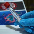Coronavirus, un nuovo caso e un decesso in Puglia nel bollettino odierno