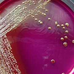 Escherichia Coli nei reflui, Acquedotto Pugliese si difende