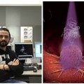 La tecnologia cambierà la chemioterapia. Lo racconta Carlo Matera, l’andriese ricercatore a Barcellona