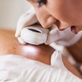  "Salviamoci la pelle ": prevenire e curare melanoma ad Andria