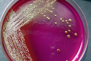 Escherichia coli